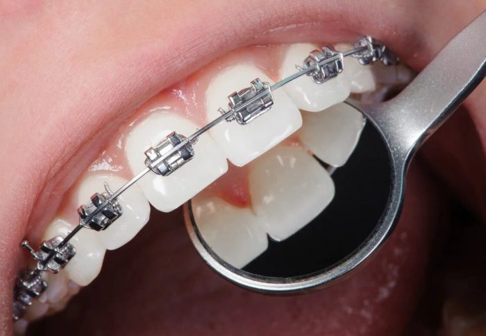 Ортодонты и ортодонтия