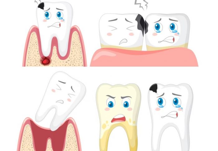 Удаление зуба: консервативные методы и их эффективность