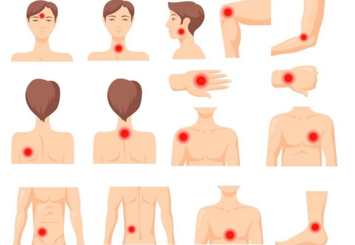 Понимание периартрита плечевого сустава: причины, симптомы и методы лечения